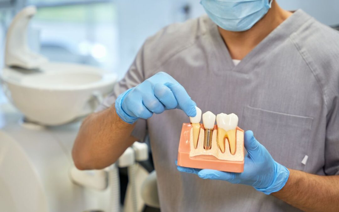Caring for Your Dental Implants 