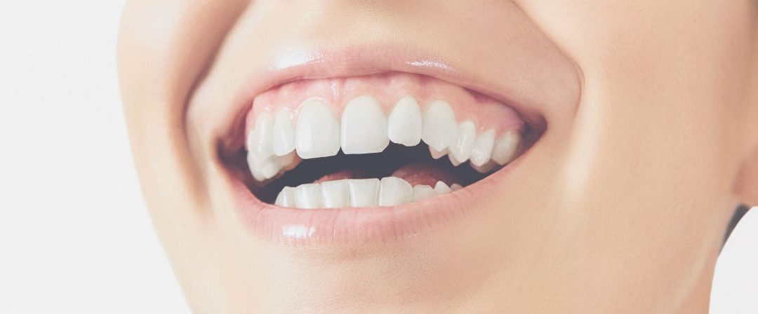 5 Common Misconceptions About Gum Disease