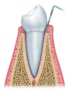 Healthy Teeth - Gum Disease Treatment Phoenix AZ