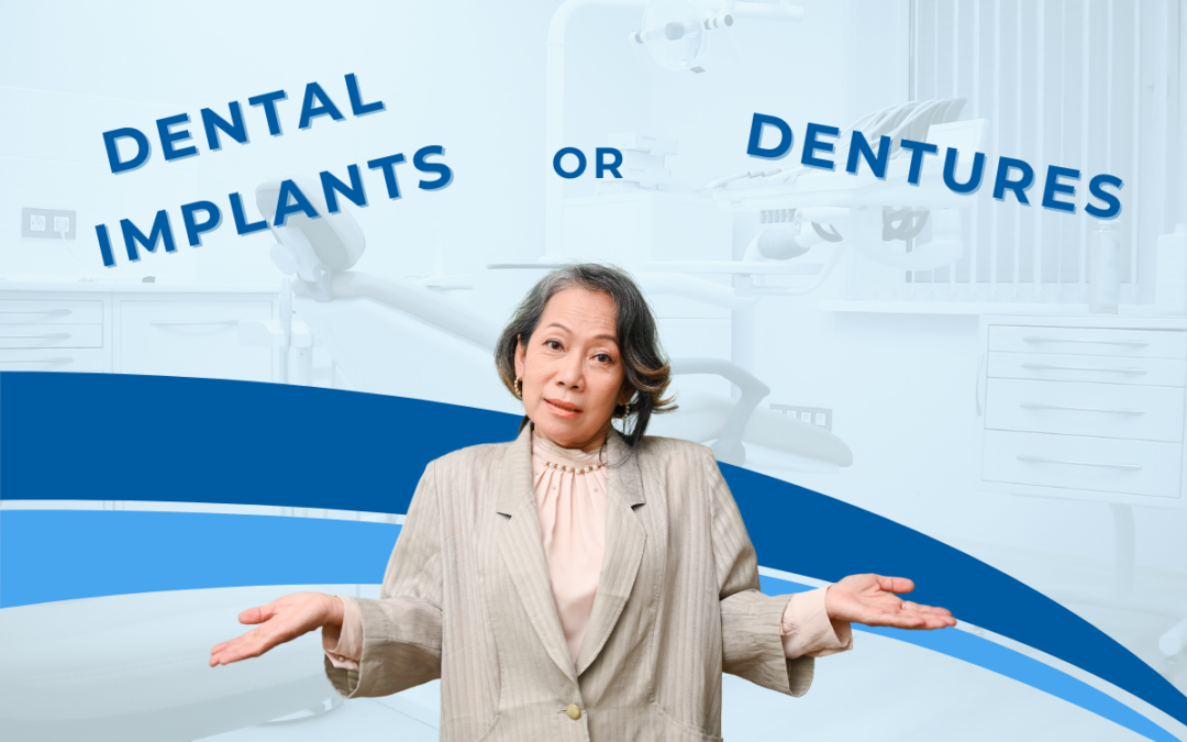 Dentures vs Dental Implants